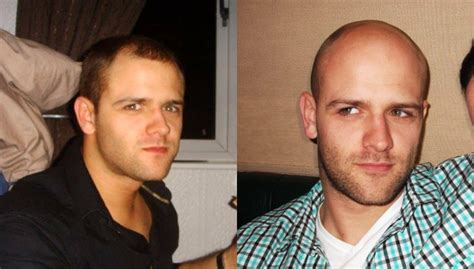 Should I Shave My Head? (Easy Step-By-Step Guide)