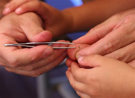 how to draw out a sliver