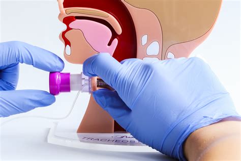 Tracheostomy PAM