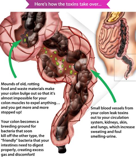 Constipation & Bowel Movement - Functional Health Network Functional