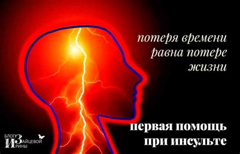Первая помощь при инсульте