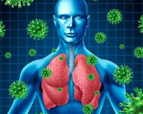 Jenis Penyakit Yang Disebabkan Oleh Virus