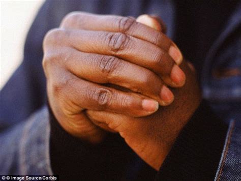 natural ways   rid  calluses  knuckles    artofit