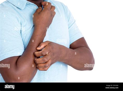 man scratching  arm stock photo alamy