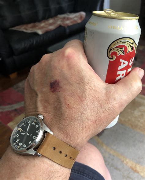 What’s your most comfortable watch? | WatchUSeek Watch Forums