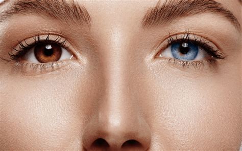 colored eyes heterochromia