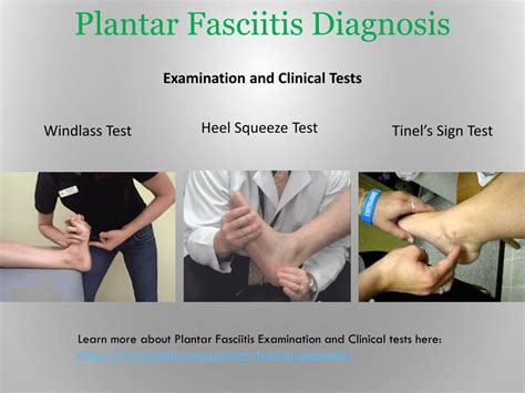 PPT - Plantar Fasciitis and Itâ€™s Treatment PowerPoint Presentation