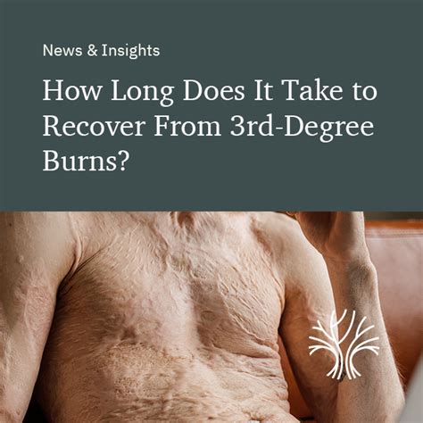how long does 3rd degree burn take to heal