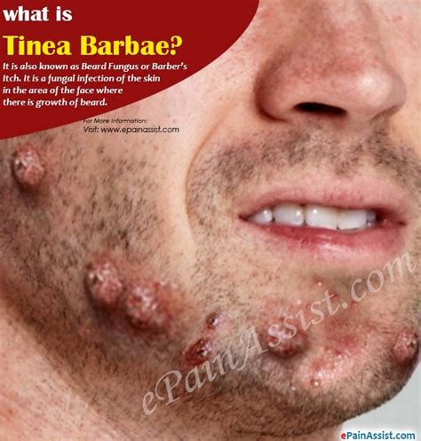 Pin on BOLI DERMATOLOGICE