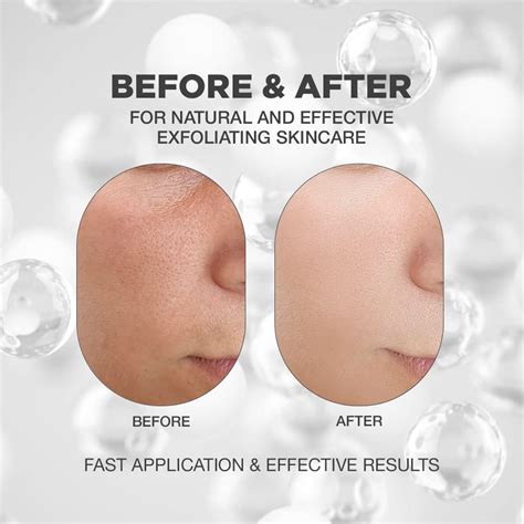 BHA Exfoliant | AHA BHA Exfoliant for Face | AHA BHA Peeling Solution ...