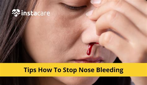 cure nose bleeding permanently
