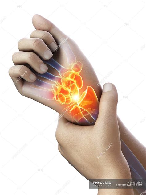 Abstract human hands with wrist pain, conceptual illustration. — sore