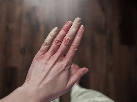 What Causes White Knuckles
