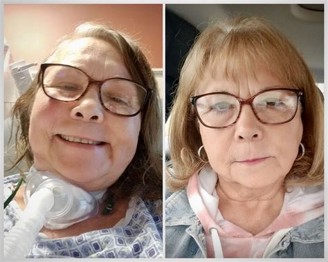A new, different me: UM Health-West patient defies odds after stroke