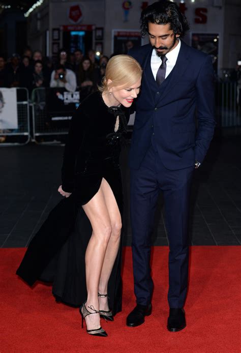 Celebrity wardrobe malfunctions that stole the show