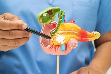 Colonoscopy Prep Poop Color Chart: What To Expect During Your Bowel Prep