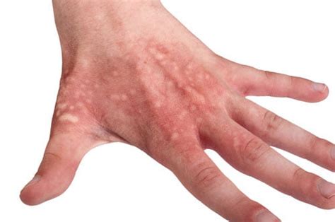 What Does It Mean When Your Left Hand Itches