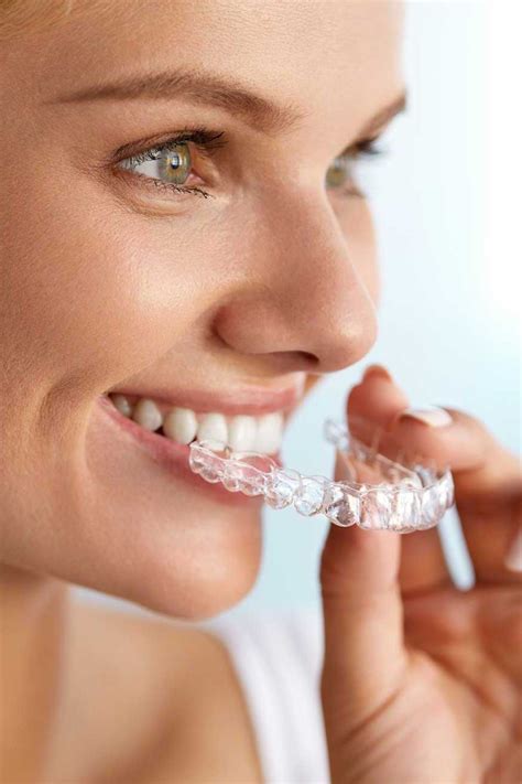 invisible braces specialist smokey point straighten  smile