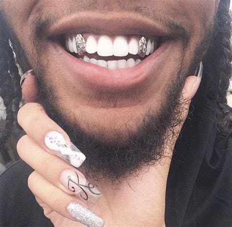 Gold Teeth Aesthetic