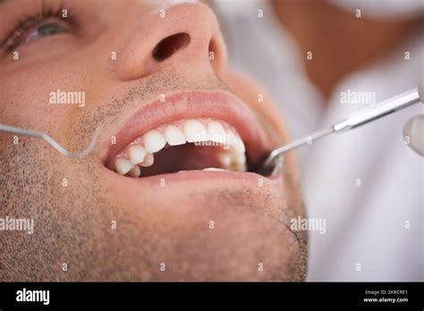 My day at the dentist. Closeup shot of a young mans teeth being ...