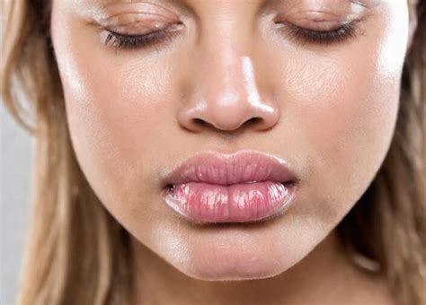 rid   swollen lip natural remedies