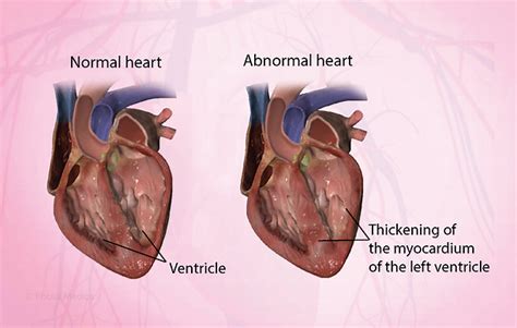 Health Condition : Symptoms, Causes, Treatment and More