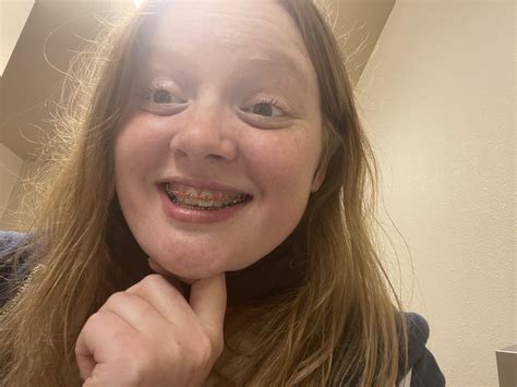 My teeth look yellow in this pic but better irl. I went for red, gonna