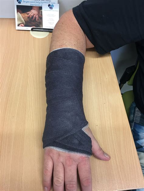 Waterproof Casting — Advanced Health & Hand Therapy