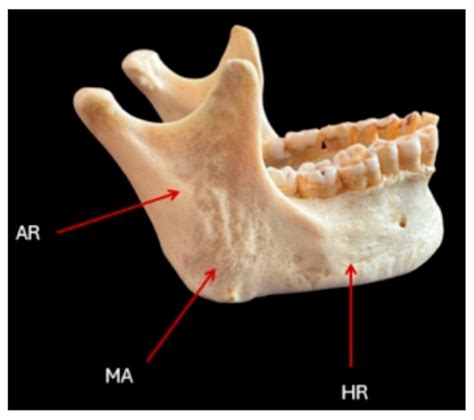 angle  mandible anatomy
