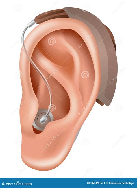 Hearing Aid. Sound Amplifier for Patients with Hearing Loss. Medicine