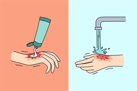 Cleaning Wound Vector Art, Icons, and Graphics for Free Download