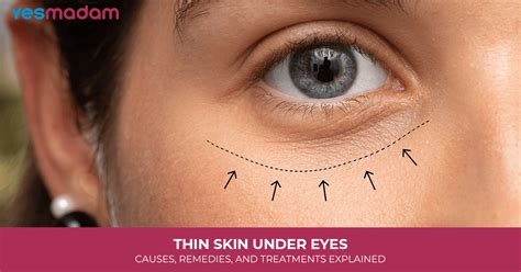 The Dark Circle Dilemma: 5 Surprising Ways To Revitalize Thin Under-Eye Skin