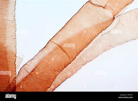 spiracles of an insect, x 100, Germany Stock Photo - Alamy