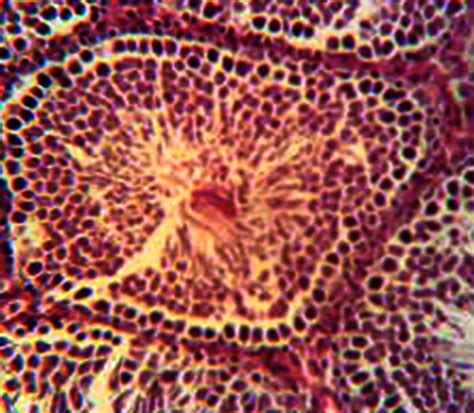 normal architecture  germinal epithelium   week control