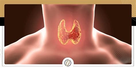Hipotiroidismo – Dr. Jorge Luis Salazar – Endocrinologo Quito