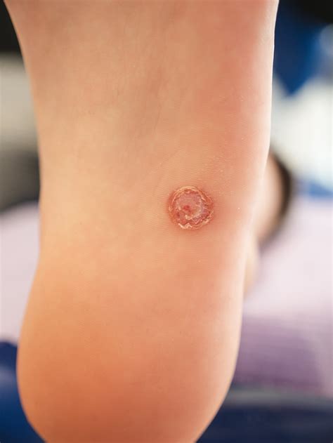 Urgent warning over virus that can be spread through 'contaminated