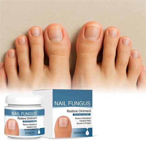 Fungi-Nail Anti-Fungal Liquid Solution, Kills Fungus That Can Lead to