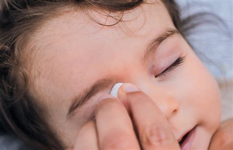 Ögoninflammation hos barn – viktiga tips för att hindra smitta! | MEDS
