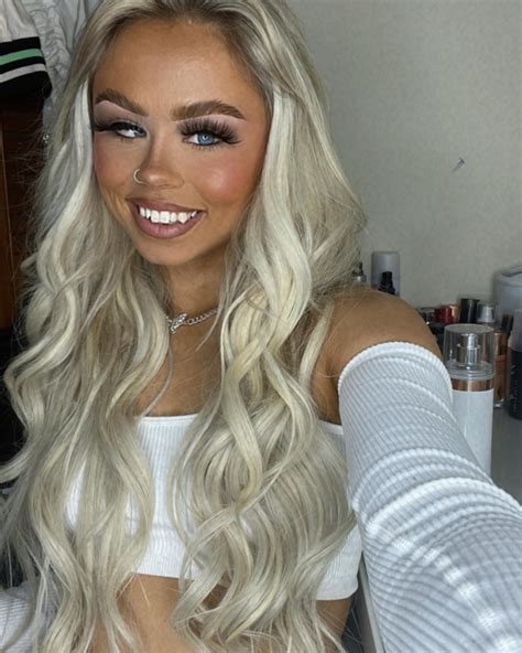 Cenapop · Modelo estrábica vence bullying e diz que já faturou R$ 1,9