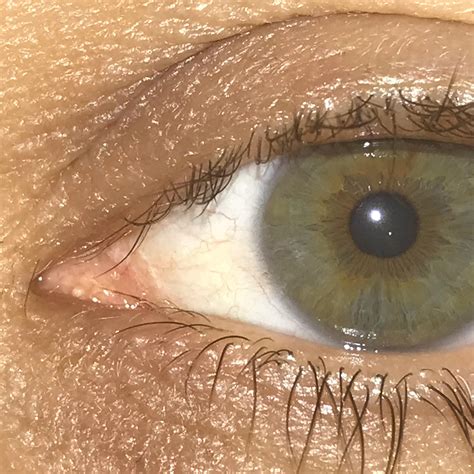 aztec sun   pupil   flower   confused