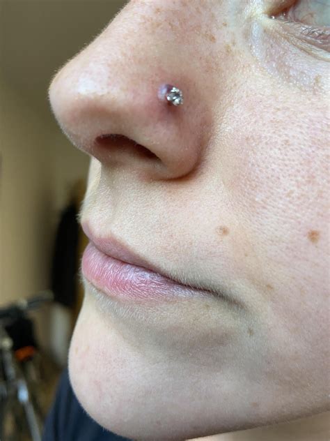 Nose piercing bump/infection from late May piercing - 3 weeks of ...