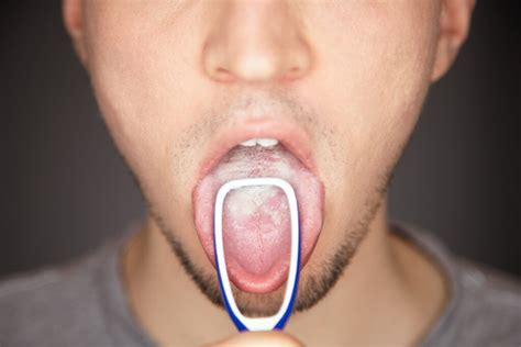 overuse  tongue scraper family tree dental
