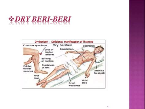 Beri beri | PPTX