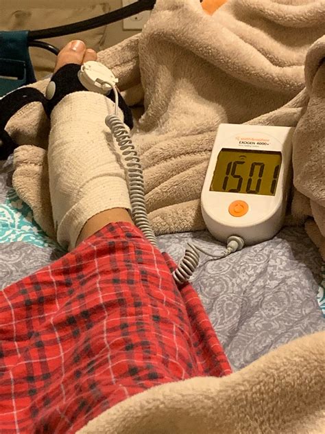 bone stimulator side effects foot