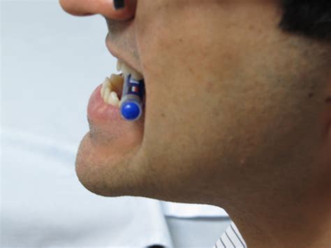 exercise for face fat 9