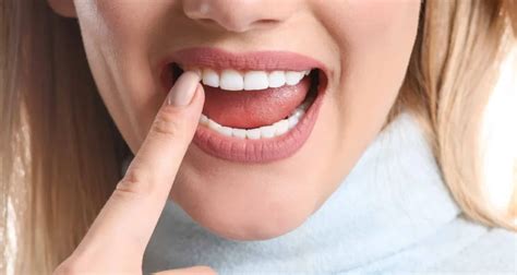 Blood Blisters in the Mouth | 6 Effective Treatments