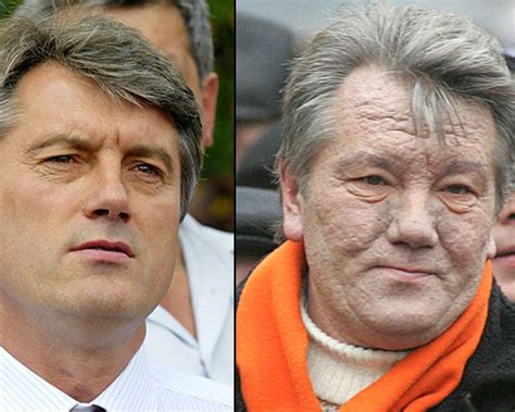 MOS: The Poisoning of Viktor Yushchenko