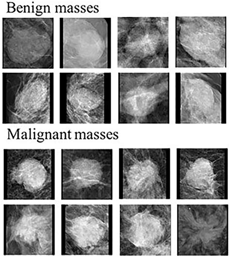 Frontiers | Applying artificial intelligence technology to assist with