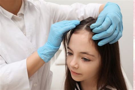 how to take out lice from your hair