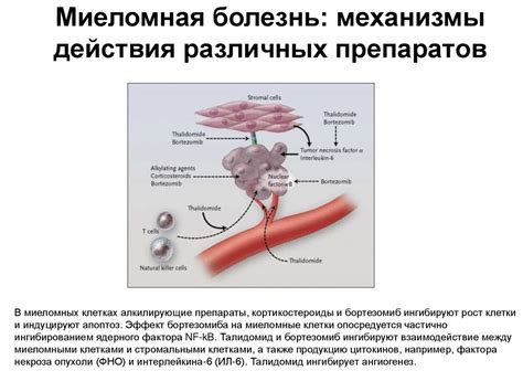 Миеломная болезнь (множественная миелома, болезнь Рустицкого-Калера ...